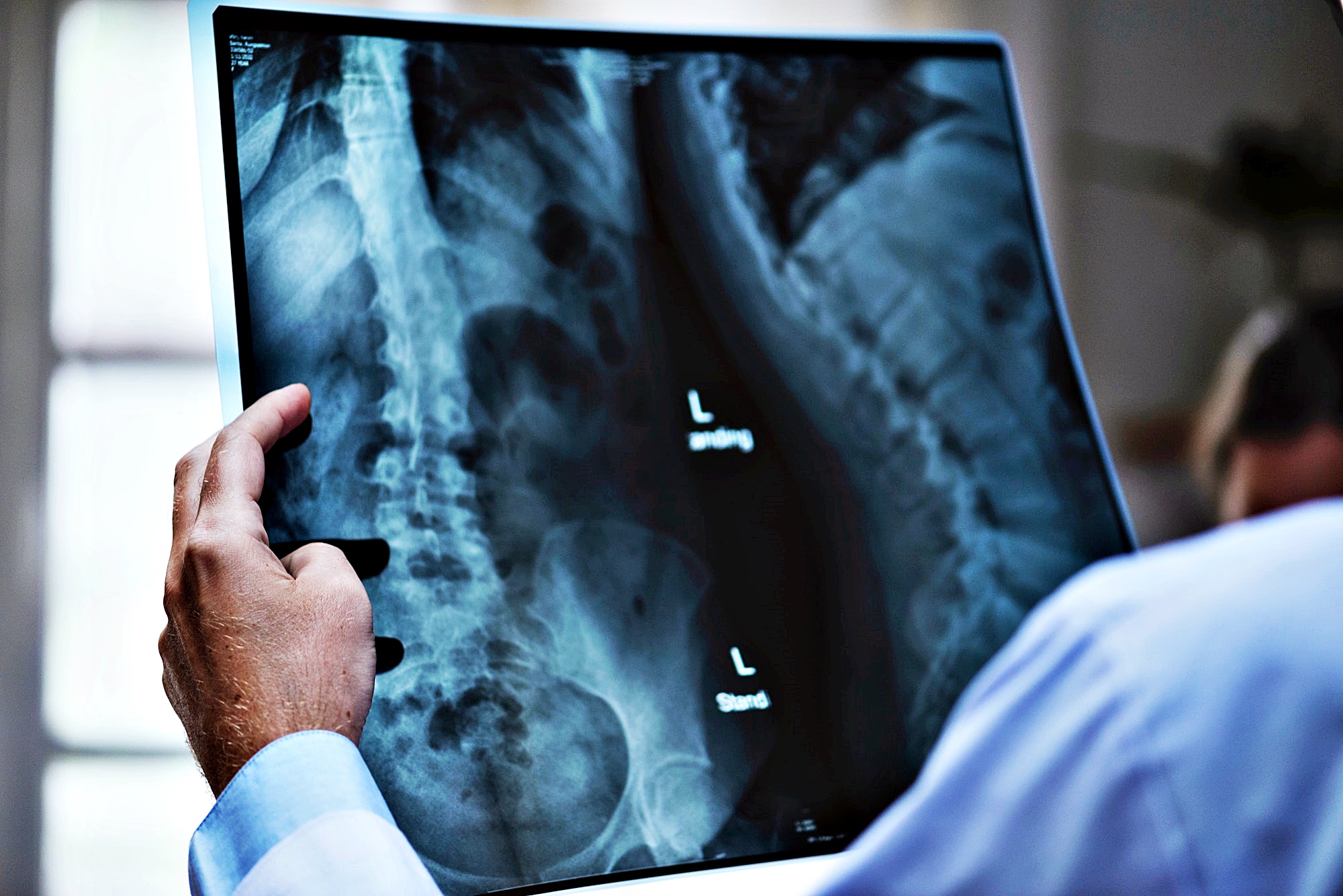 Operația de hernie de disc – 9 detalii interesante despre o intervenție de care tot mai mulți au nevoie