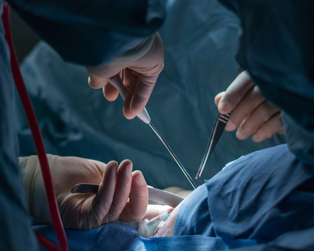 În unele cazuri, ocluzia poate necesita intervenția chirurgicală