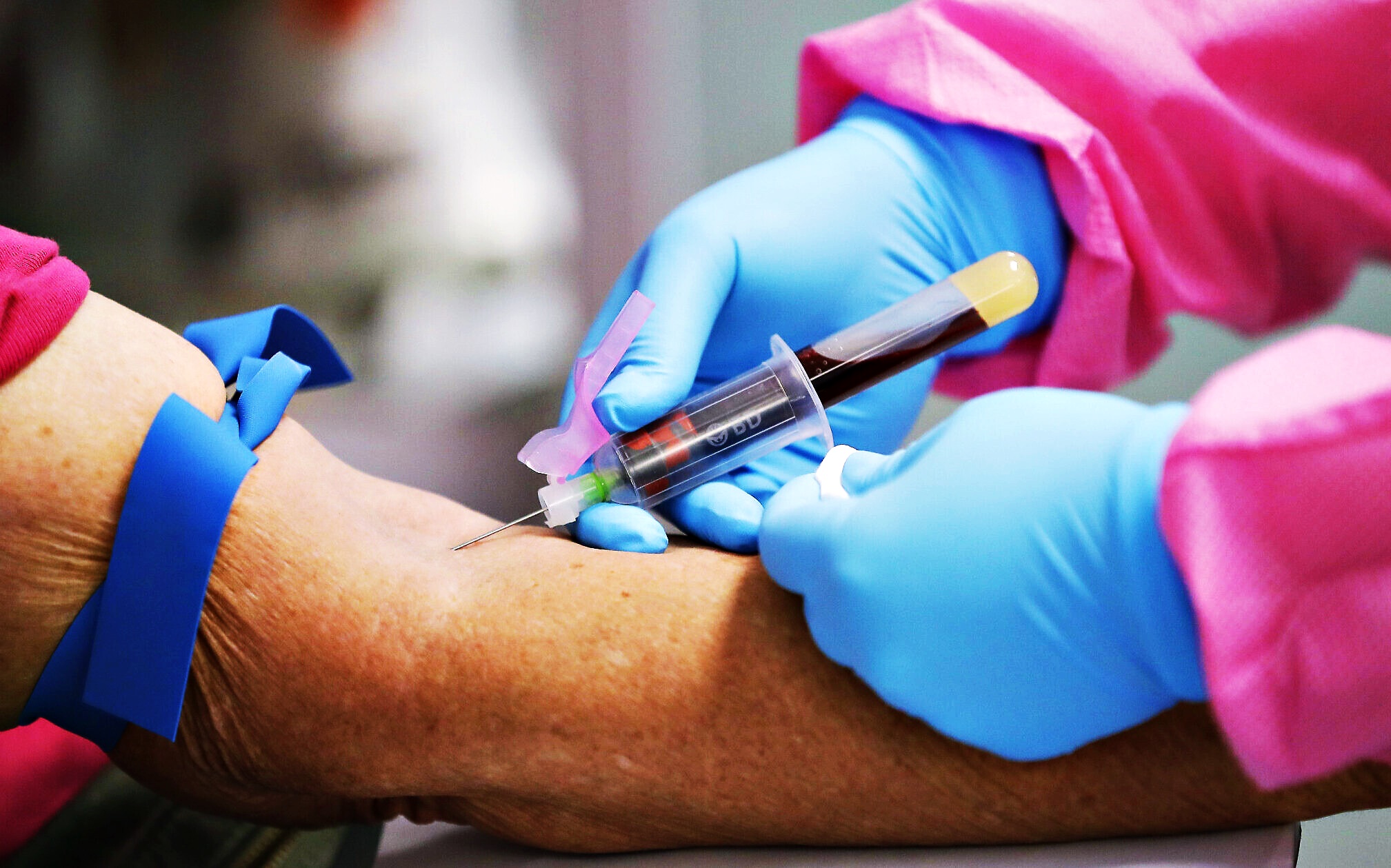 Ce să nu faci înainte de analize pentru ca rezultatele să fie corecte