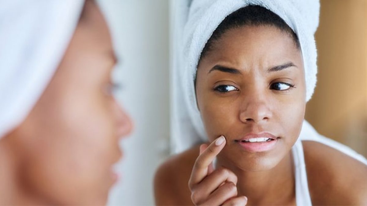 Anumite produse cosmetice favorizează apariția acneei