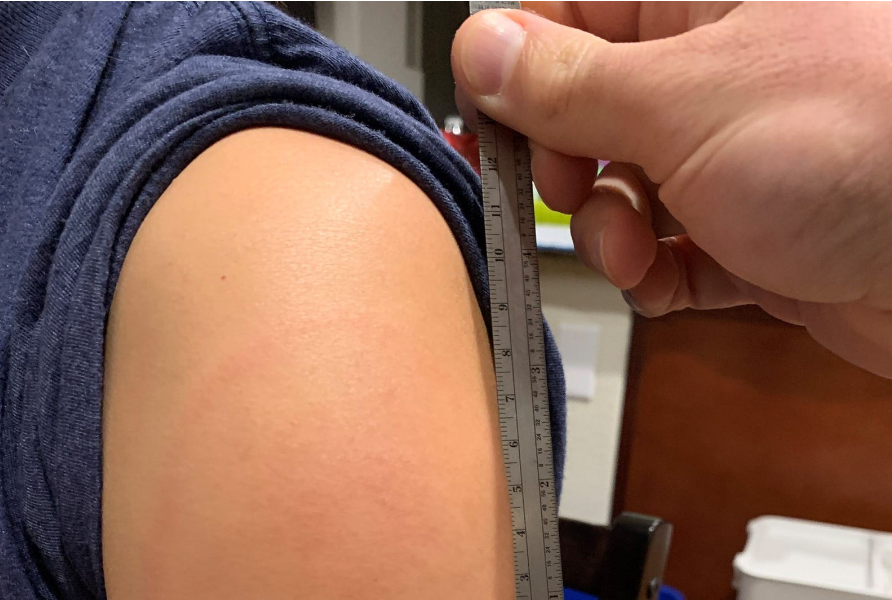 Efectele adverse ale vaccinului Moderna