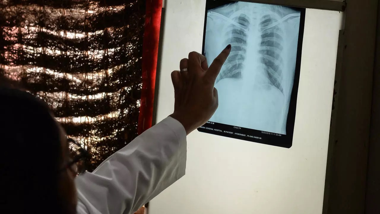 Cei care au scapat de Covid-19 trebuie sa ramana sub supravegherea medicilor