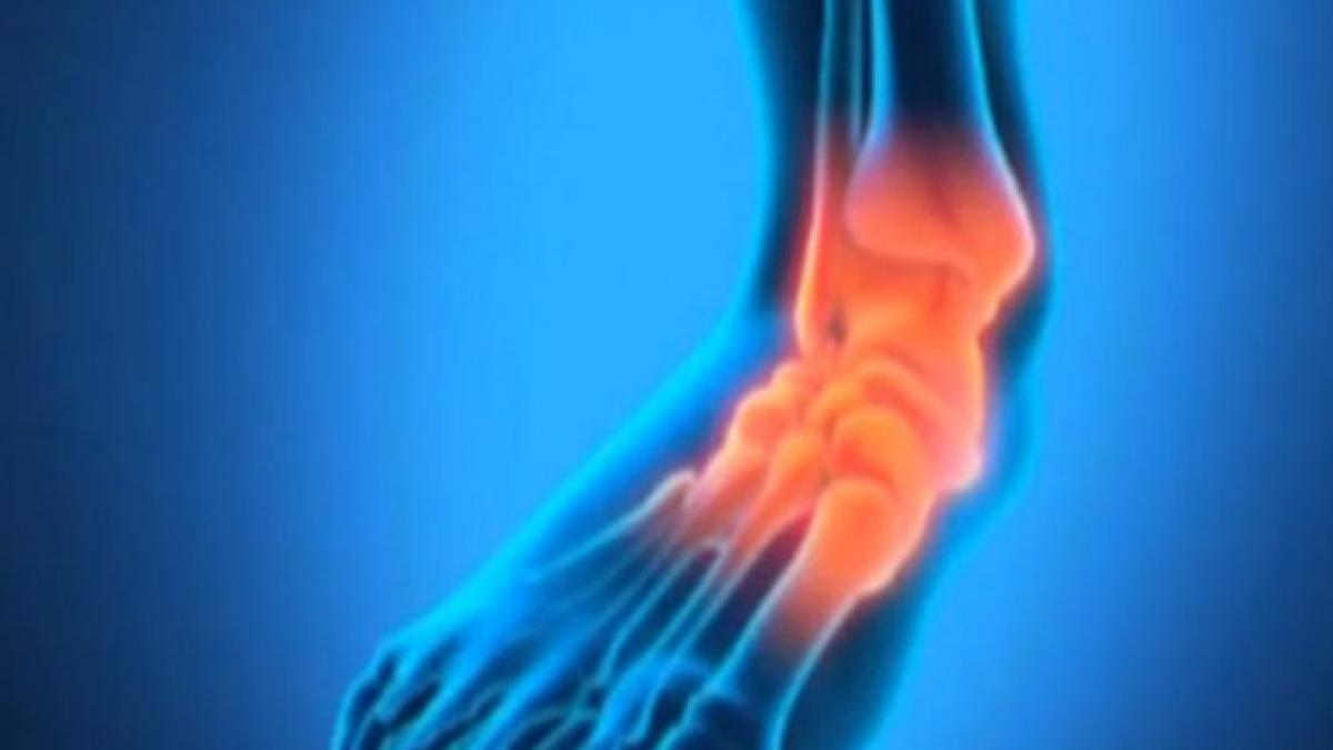 dureri articulare pe interiorul genunchiului