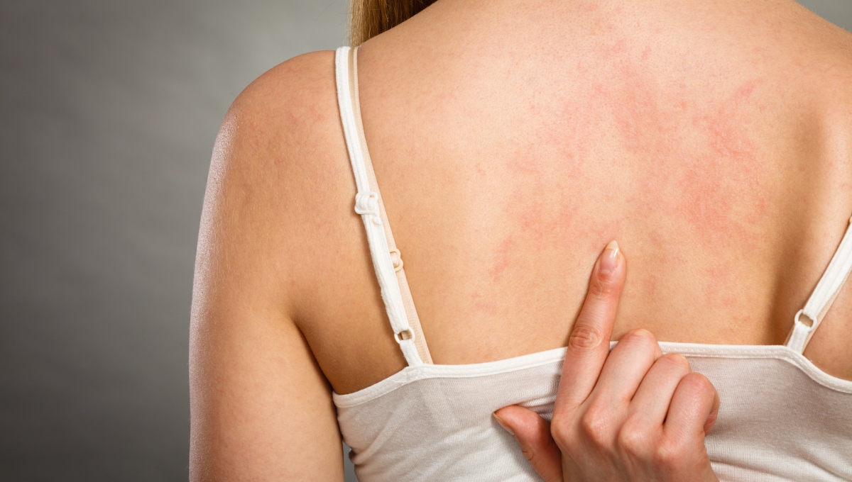 Ce afecțiuni se pot ascunde în spatele mâncărimii de piele 