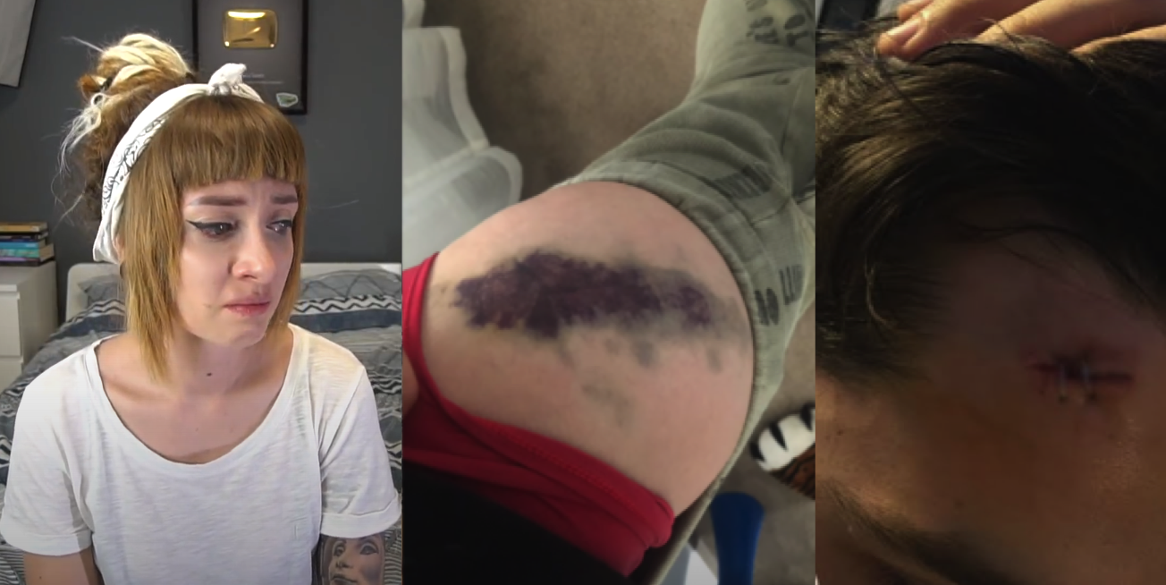 Vedete atacate în public. Tequila a fost lovită în public cu o bară de fier 