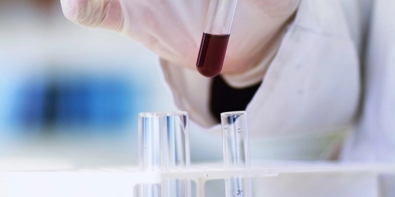 Cum pot ajuta celulele stem în lupta anti-Covid. Sfaturi prețioase de la specialiști