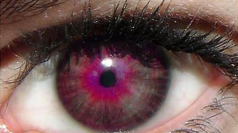 Ochii de culoare rosie