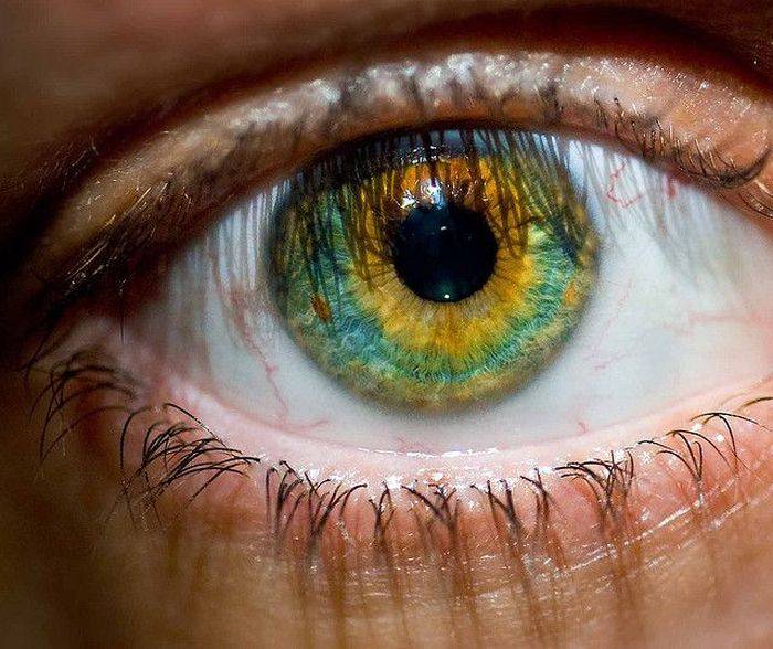 Ochii in doua culori