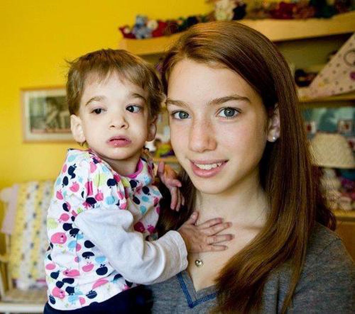 Fetița care nu a îmbătrânit niciodată, alături de sora sa