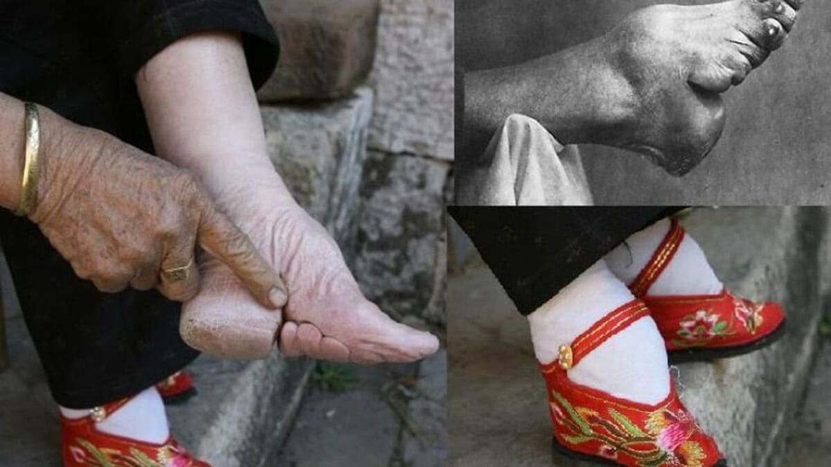 Legarea picioarelor: ritualul din China care a torturat miliarde de femei
