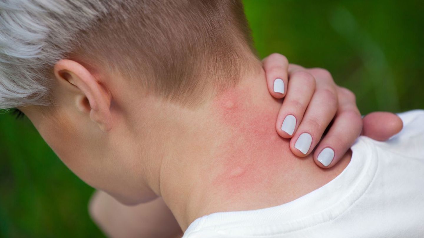 Cum ne protejăm de căpușe și țânțari. Sfaturi și recomandări prețioase direct de la medic